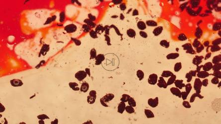 皮氏血细胞[免费商用]