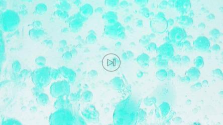 表面下的蓝色球体[]