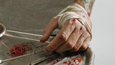 绑着绷带的手放在装满刑具的托盘上[免费商用]