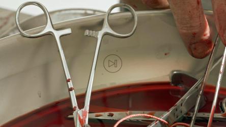 沾满鲜血的手拿起镊子作为折磨武器[免费商用]