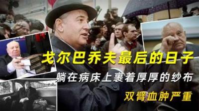 戈尔巴乔夫最后的日子：躺在病床上裹着厚厚的纱布，双臂血肿严重