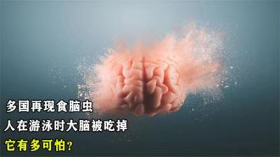 多国再现食脑虫，人在游泳时大脑被吃掉，它有多可怕？如何预防？