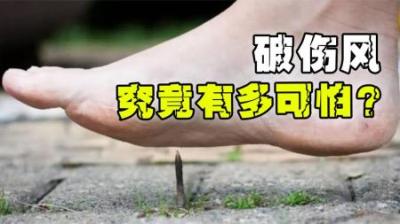 一根生锈的铁钉，触发诡异的人体拱桥状姿势？