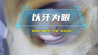 神奇的“眼中牙”手术，你见过吗？