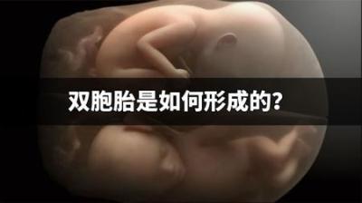 你知道双胞胎是如何形成的吗？