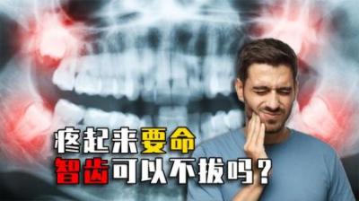 疼起来要命！为啥偏偏有的人不长智齿？智齿一定要拔掉吗？