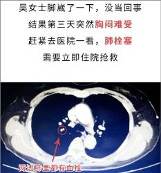 有哪些你以为的小毛病，其实是大病？(图)