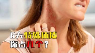 一做数学题眼睛就过敏，一蹲厕所就流泪，6大特殊体质你占几个？