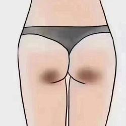 人的屁股为什么会有两团黑？