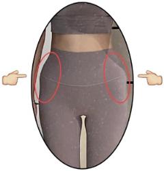 为什么很多女生屁股两侧，会有个小凸起？
