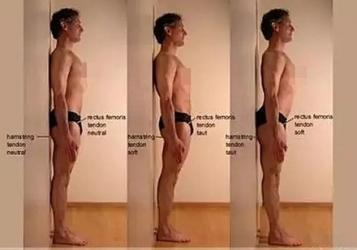 屁股太翘，有多危险？