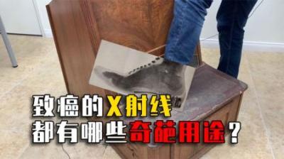 致癌的X射线，为啥被用来试鞋、脱毛甚至选美？他们后来怎样了？