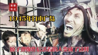1945年日本广岛原子弹爆炸，8.8万人当场死亡，活着的人严重烧伤