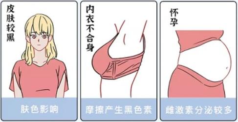 关于女生胸部，你必须知道的6个正经小知识！(图)