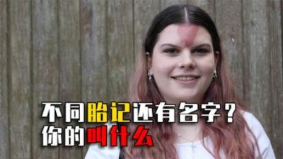 不同胎记都叫什么名字，有的几乎人人都有，你的叫什么？