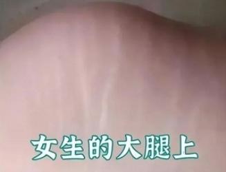 为啥很多女生屁股上，会有一片白色条纹？