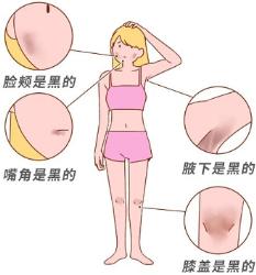 女生身体的这些部位为啥总是黑黑的？(图)