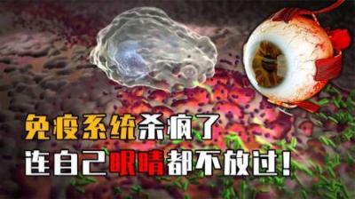 人的身体不承认眼睛的存在？免疫系统杀疯了，连眼睛都不放过？