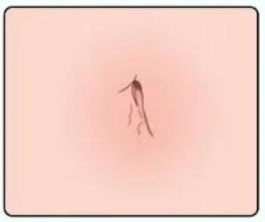 为啥肚脐眼有凹有凸？跟护士的打结手法有关吗？