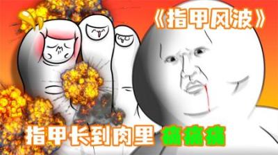 [视]《指甲风波》当你指甲长到肉里，分分钟把你疼晕过去~