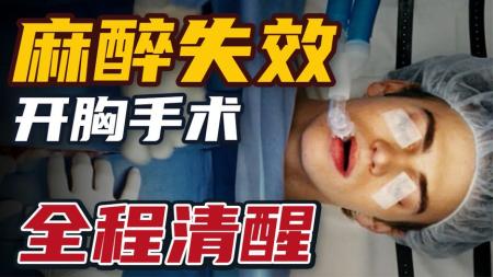 [文]《夺命手术》麻醉失效！清醒被开刀有多可怕！悬疑惊悚片《夺命手术》