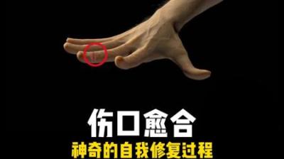 [视]伤口神奇的自我修复过程，看看你的身体究竟有多爱你 #人体奥秘