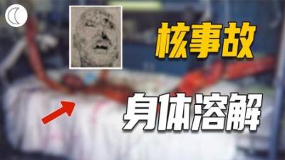 [视]83天身体溶解，身体腐败如烂泥，近距离接触巨量辐射会怎样？