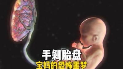 [视]手剥胎盘，宝妈最恐怖的噩梦 #涨知识 #胎儿 #人体 #怀孕