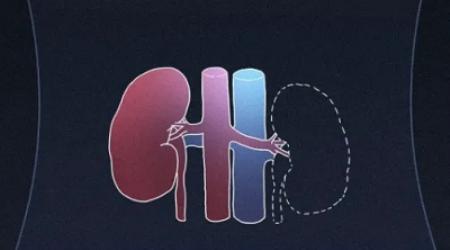 男生少了一个腰子，身体会发生什么变化？(图)