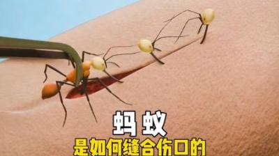 [视]蚂蚁是如何缝合伤口的 #涨知识 #科普 #蚂蚁 #科普一下