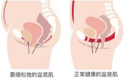 女性长期禁欲，会有什么后果？