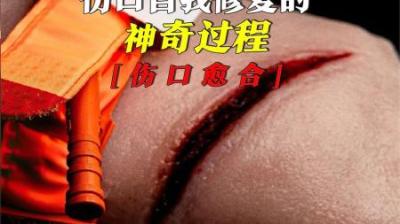 [视]伤口自我修复的神奇过程，看看身体都为你做了什么？
