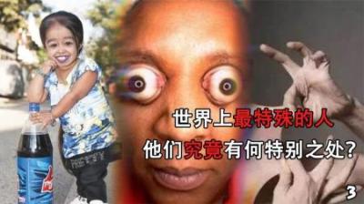 [视]世界上最特殊的人，你见过吗，将颠覆你的认知？