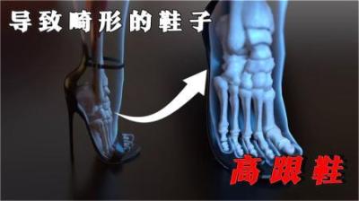 [视]给男人发明的鞋子，却让女人付出惨痛的代价，它隐藏着那些危害？