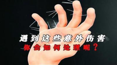 [视]如果被仙人球扎了怎么办？#受伤 #科普一下#涨知识#仙人球 #豪猪