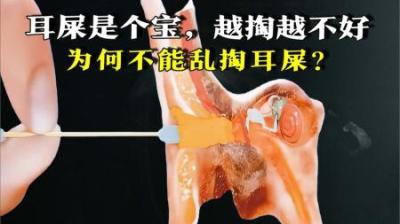 [视]耳屎是个宝，越掏越不好，为何不能乱掏耳屎？