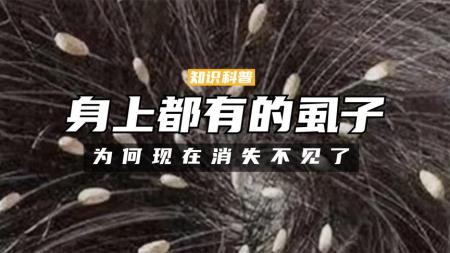 [文]30年前几乎每人身上都有的虱子！为何至今消失没有了？ 虱子解说文案素材