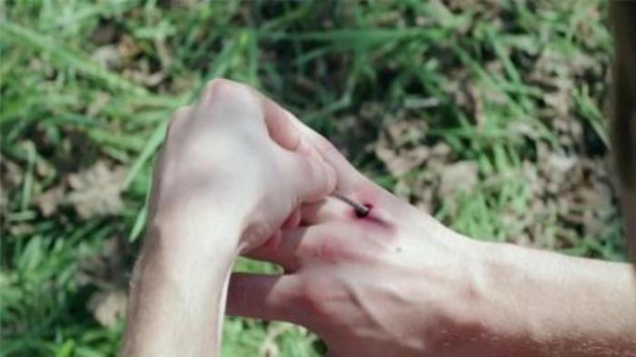 《生长》：科学家研制出治病寄生虫，它们将寄生虫注入病人体内，不料寄生虫发生变异，把人类作为繁殖工具。-吾爱原创解说文案-[原创首发]-吾爱文案网