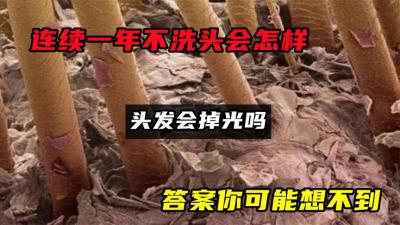 连续一年不洗头会怎样？头发会掉光吗？答案你可能想不到-原创解说文案