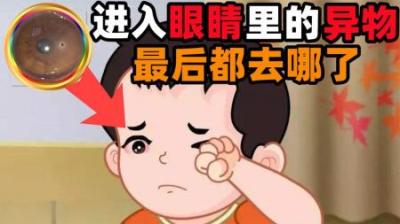 进入眼睛而没柔出来的异物，最后都去哪了？-原创解说文案