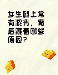 女生腿上常有淤青的原因大揭秘