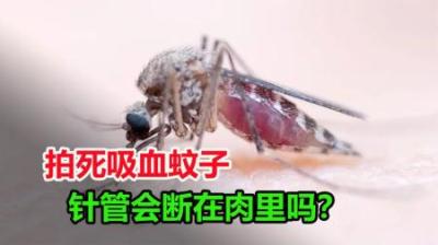 把正在吸血的蚊子拍死，它的口器会断在肉里吗？-原创解说文案
