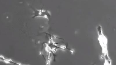 学习让神经元生长，大脑神经元网络影响聪明程度与思考能力 .大脑神经元激活训练