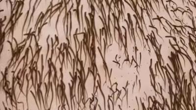 用刀刮毛为何更粗？家用脱毛仪推荐之Beautigo奶冻冰淇淋款 .beautigo