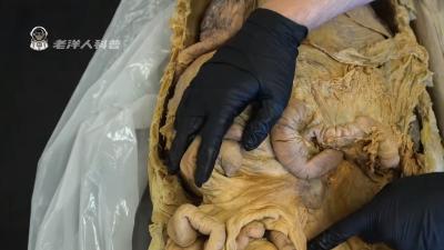 经常吃零食危害大：高盐高糖高脂肪，还易成瘾影响健康 .老洋人科普