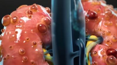 喝可乐后的身体变化：糖分、咖啡因影响，还可能致胖，少喝为妙 .无糖可乐