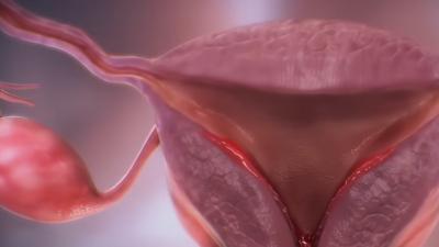 女生长期不来月经的危害、生理期护理及选卫生巾要点 .自由点益生菌Pro