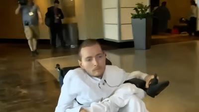 俄罗斯富豪七千万换头手术计划，猴子实验及伦理争议引发关注 .换头手术成功案例