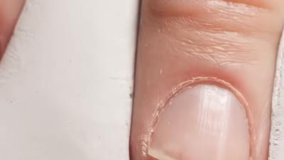 指甲作用大揭秘：保护甲床、完成精细动作及修剪注意事项 .甲床短怎么养长