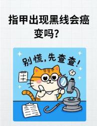 指甲黑线癌变预警？这些症状再不重视就晚了！